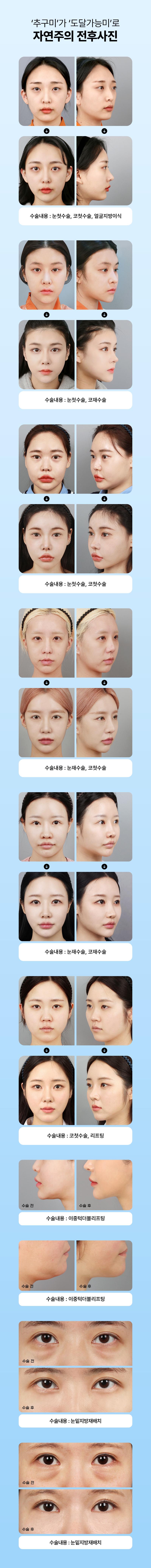 추구미가 도달가능미로 자연주의 전후사진