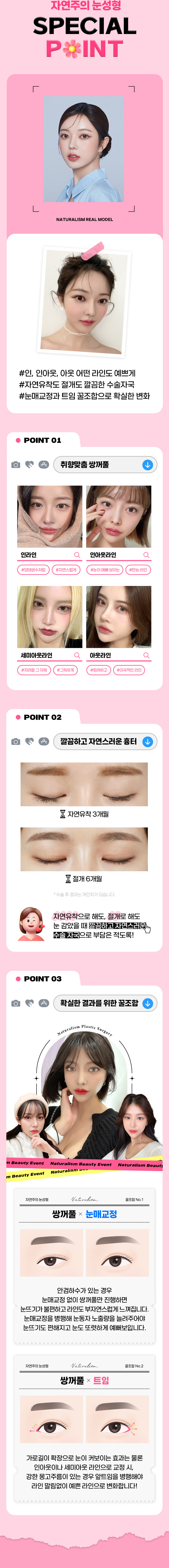 자연주의 눈성형