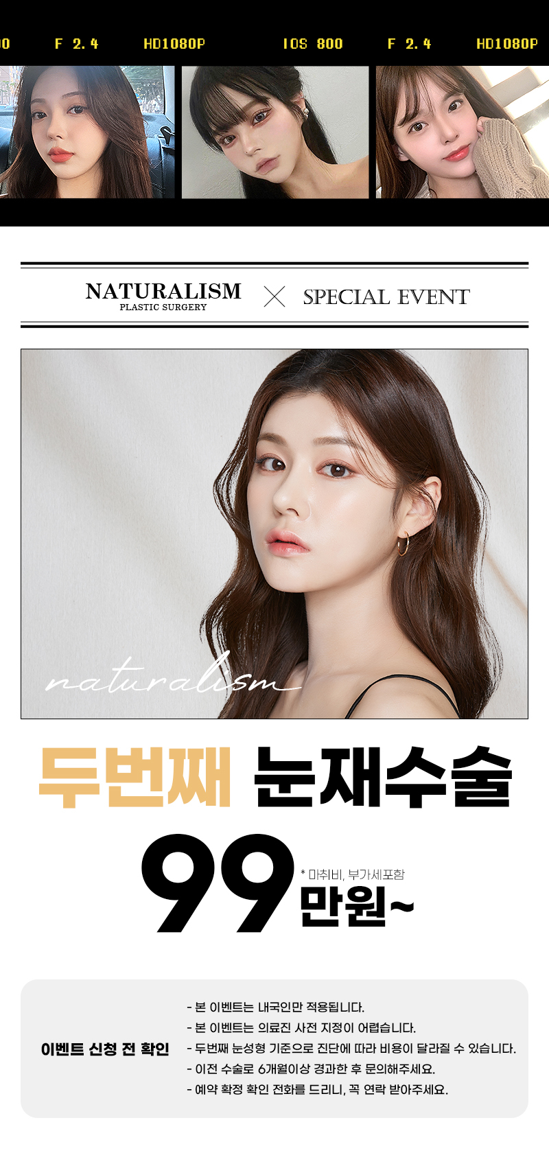 두번째 눈재수술