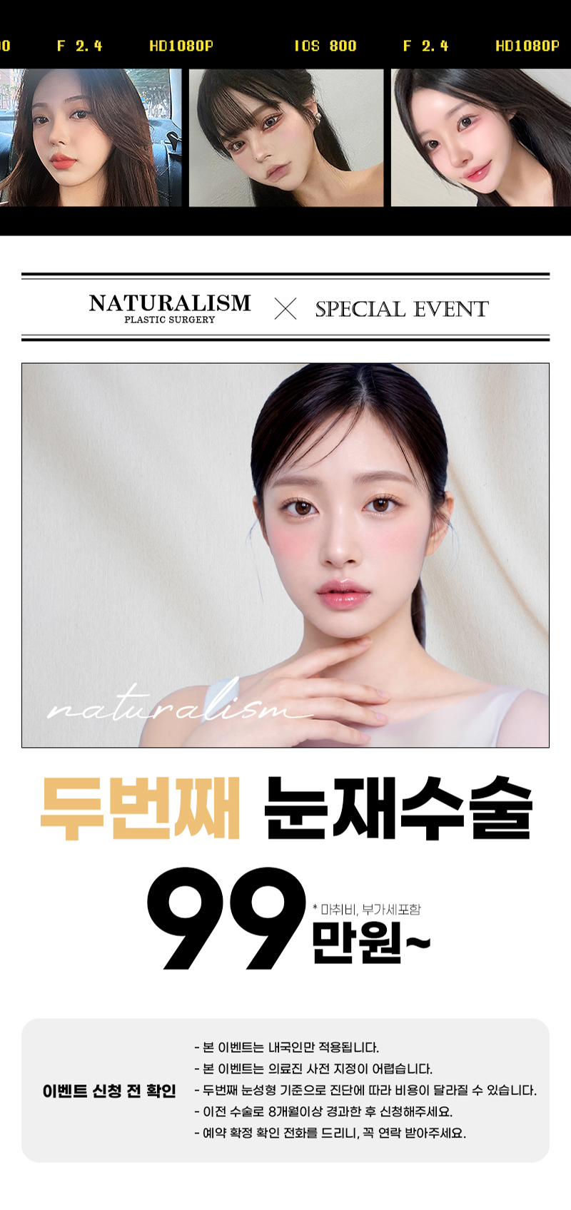 두번째 눈재수술