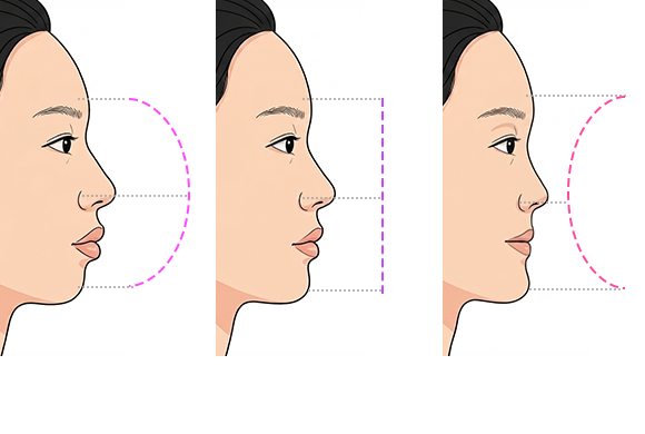 환자 케이스별 라인 설계