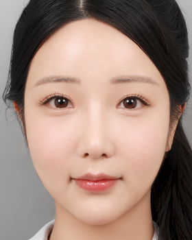 CASE 03 수술 후 정면