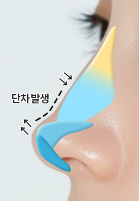 단차 개선 전