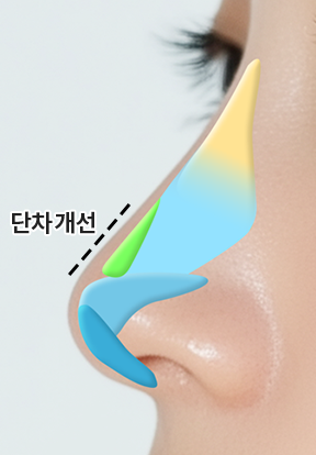 단차 개선 후