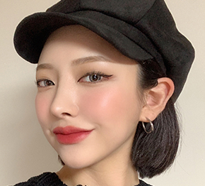 수술 후 사진 2