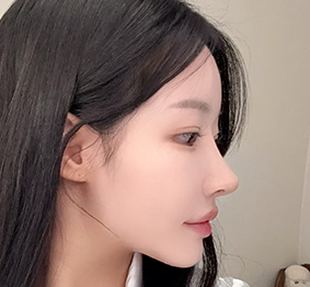 수술 후 사진 3