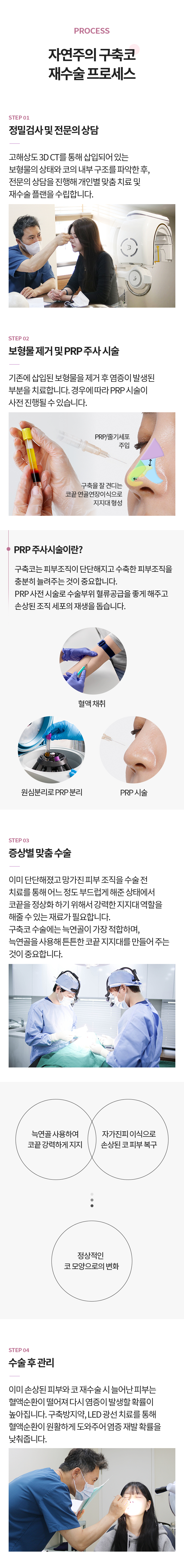 구축코재수술